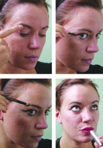 Deep vein Thrombosis